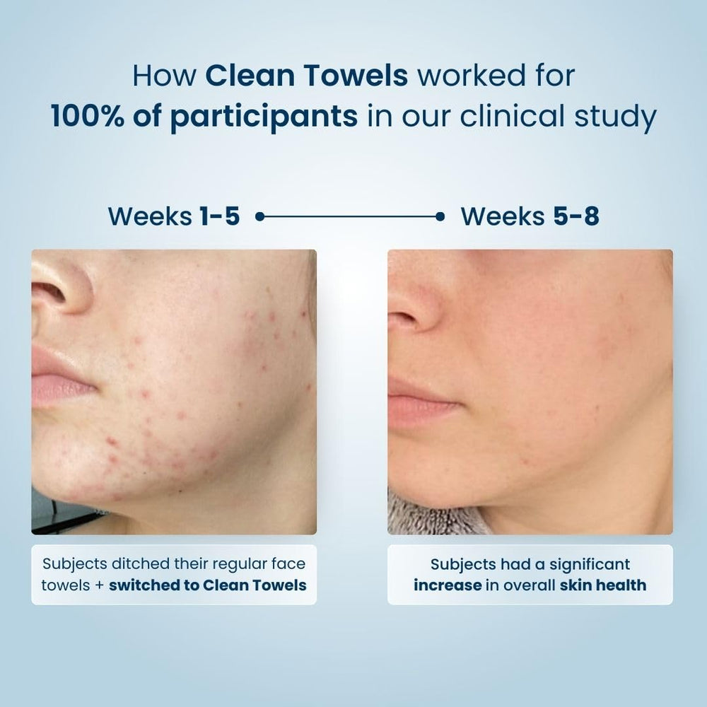Clean Skin Club Clean Towels XL 100% USDA Biobased Face Towel, Disposable Face Towelette, Eczema Association Accepted, Makeup Remover Dry Wipes, Ultra Soft, 50 Ct, 1 Pack