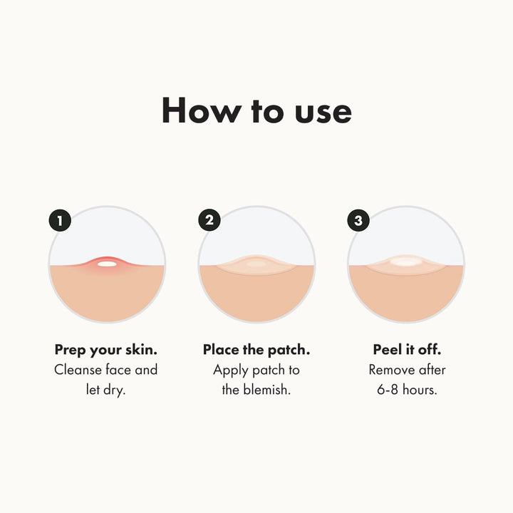 Mighty Patch Original – Hero Acne Spot Patch for Zits & Skin